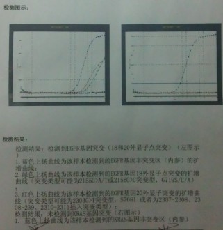 基因检测.jpg